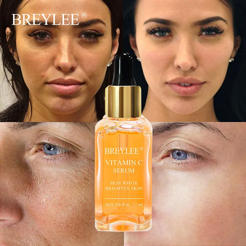 

BREYLEE Vitamin C Serum Face Whitening Essence Brighten Skin Fade Dark Spots Remove Freckle Pigment Melanin Remover Facial Care