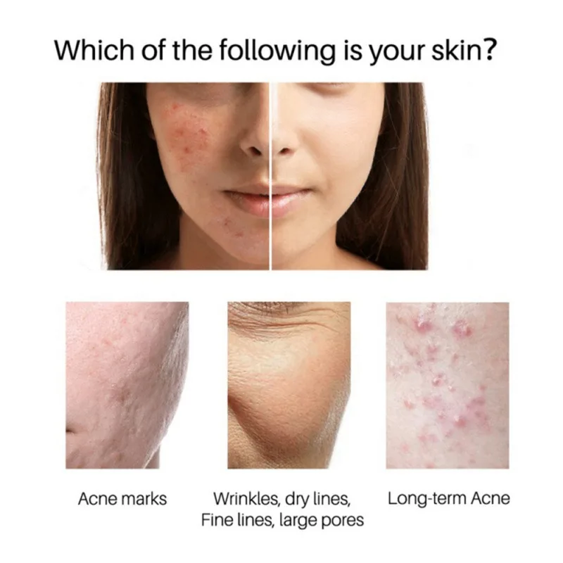 

30%Glycolic Acid15ml