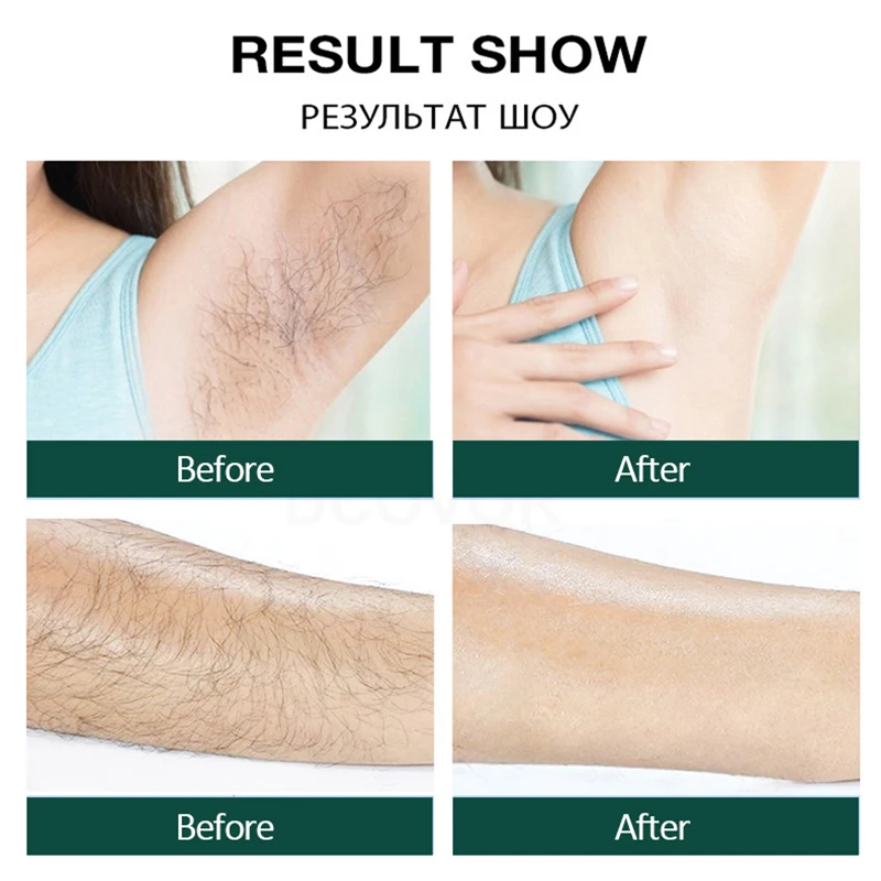 

Full Body Ipl Hair Removal Device Electric Laser Epilator 5 Gears Portable Photoepilator Painless Flash Hair Remover Machine