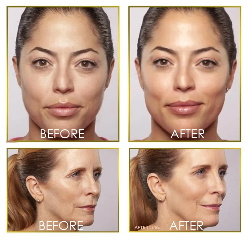 Dermaplaning средство для удаления волос с подсветкой, для лица, Expoliator, электрическая бритва Леди, бритва для лица, бритва для волос, безболезненные Expoliates, омертвевшая кожа