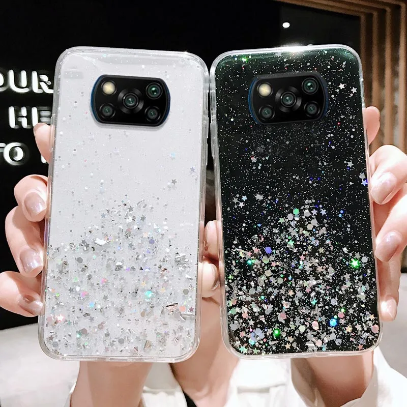 

Poco X3 Pro Case For Xiaomi Mi 11 Lite Ultra 10T Pro Note 10 Lite Cases Silicone Funda Xiaomi Poco F3 M3 Pro X3 GT Glitter Cover
