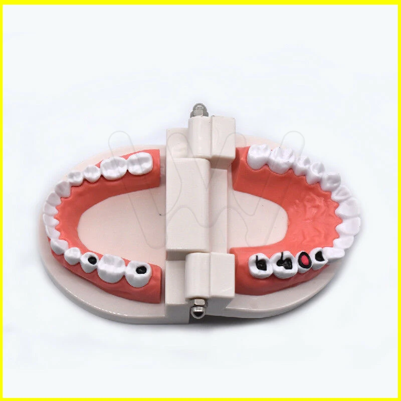 Стоматологическое обучение модель зубов кариес уход за зубами образование