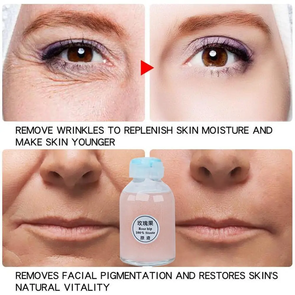 

30ml Shrinking Serum Essence Pores Brighten The Complexion And Rejuvenate The Skin Original Liquid Skin Care