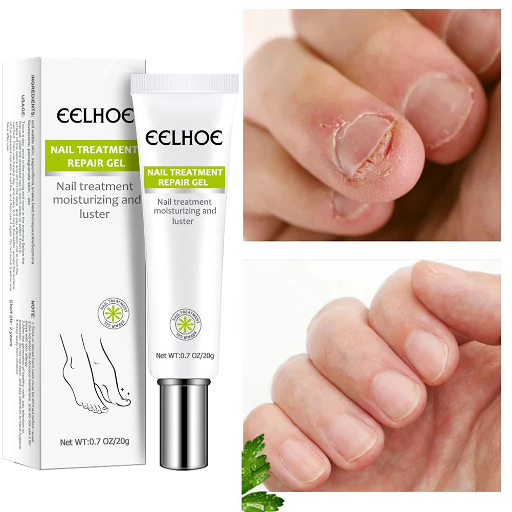 

1pcs Hot sale Nail Repair Gel for Finger Toe Nails Nail Strengthener Recovery for Cracked Weak Broken Damaged Nail Fast delivery