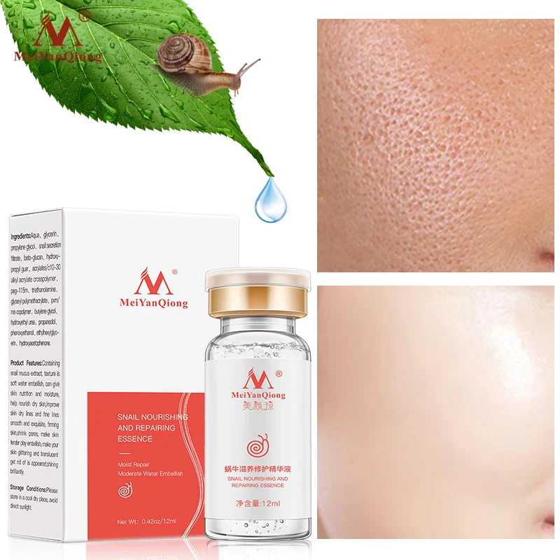 MeiYanQiong натуральный с экстрактом улитки жидкая Гиалуроновая кислота отбеливание