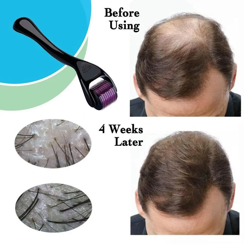 0.3mm Micro Needle 540 Roller Derma Roller Titanium Hair Regrowth Beard Growth Anti Hair Loss Treatment Thinning Receding