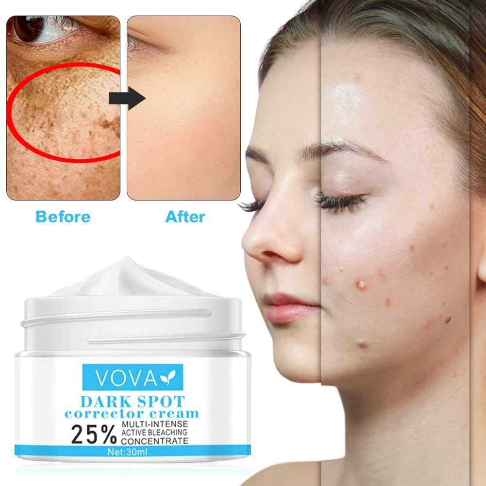 

Effective Remove Melasma Acne Spot Pigment Melanin Dark Spots Pigmentation Whitening Freckle Cream Moisturizing Gel Skin Care