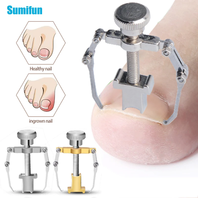 

1Pcs Recover Ingrown Toe Nail Correcter Toenails Clipper Brace Correcect Toe Paronychia Nail Brace Tool Pedicure Foot Nail Care