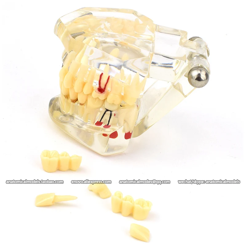 

12629/CMAM Human tooth model anatomy