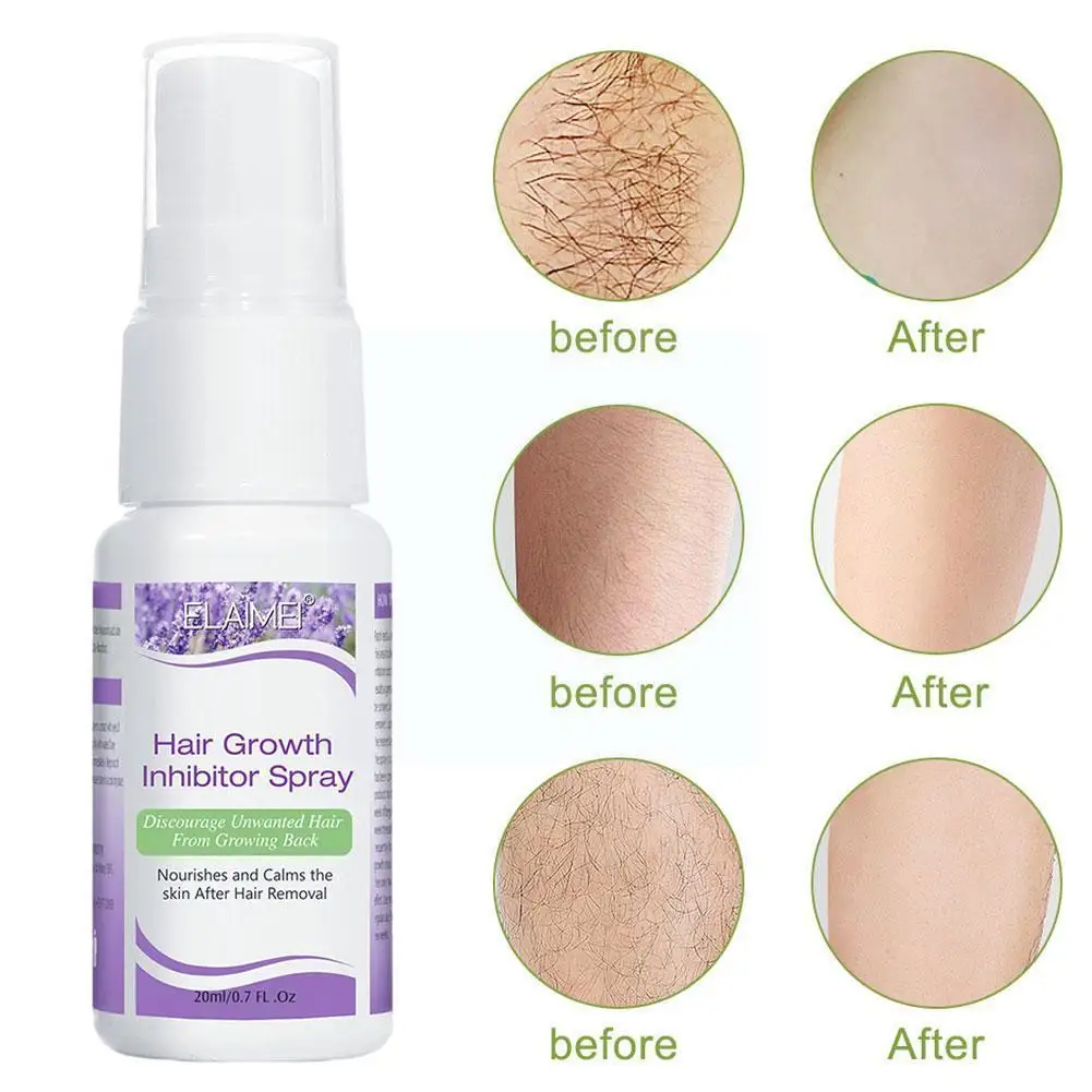 

20ML Hair Removal Spray Effective Painless Shrink Nourish Hair Gentle Growth Inhibitor Wax Pores Inhibitor Remova Q6S1