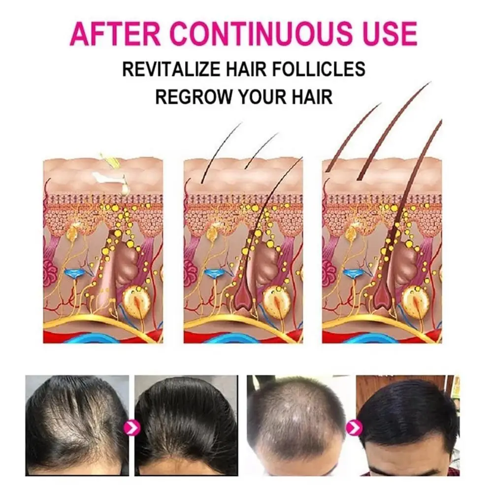 Sevich Hair Treatment Serum Growth Spray Black Anti Product Loss Repair White Restoration Hai A1y2 | Красота и здоровье