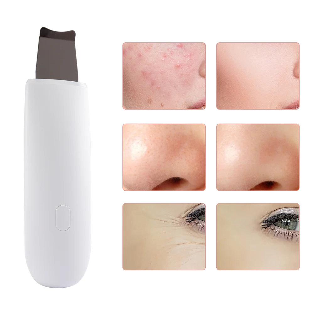 Перезаряжаемый ультразвуковой скребок для кожи аппарат очистки пор пилинга