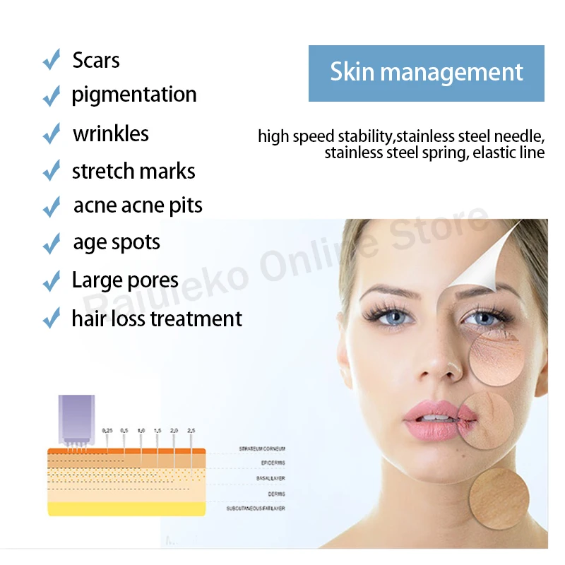 10/20/50 шт MYM винт Сменные чернила для татуировки Microneedling 9 Pin/12 контактный/36
