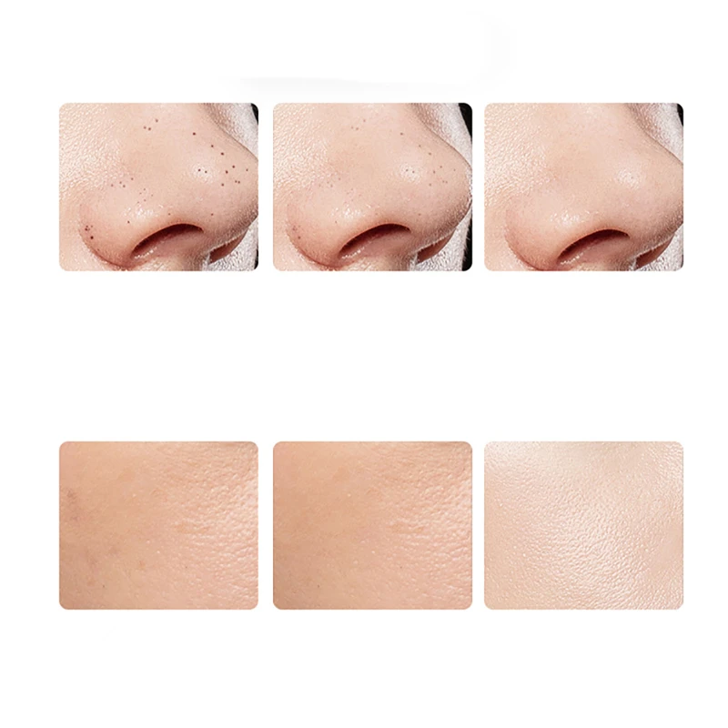 

Ultrasonic Facial Skin Scrubber Skin Deep Cleaner Shovel Spatula Facial Pore Blackhead Acne Cleaning Skin Care Tool