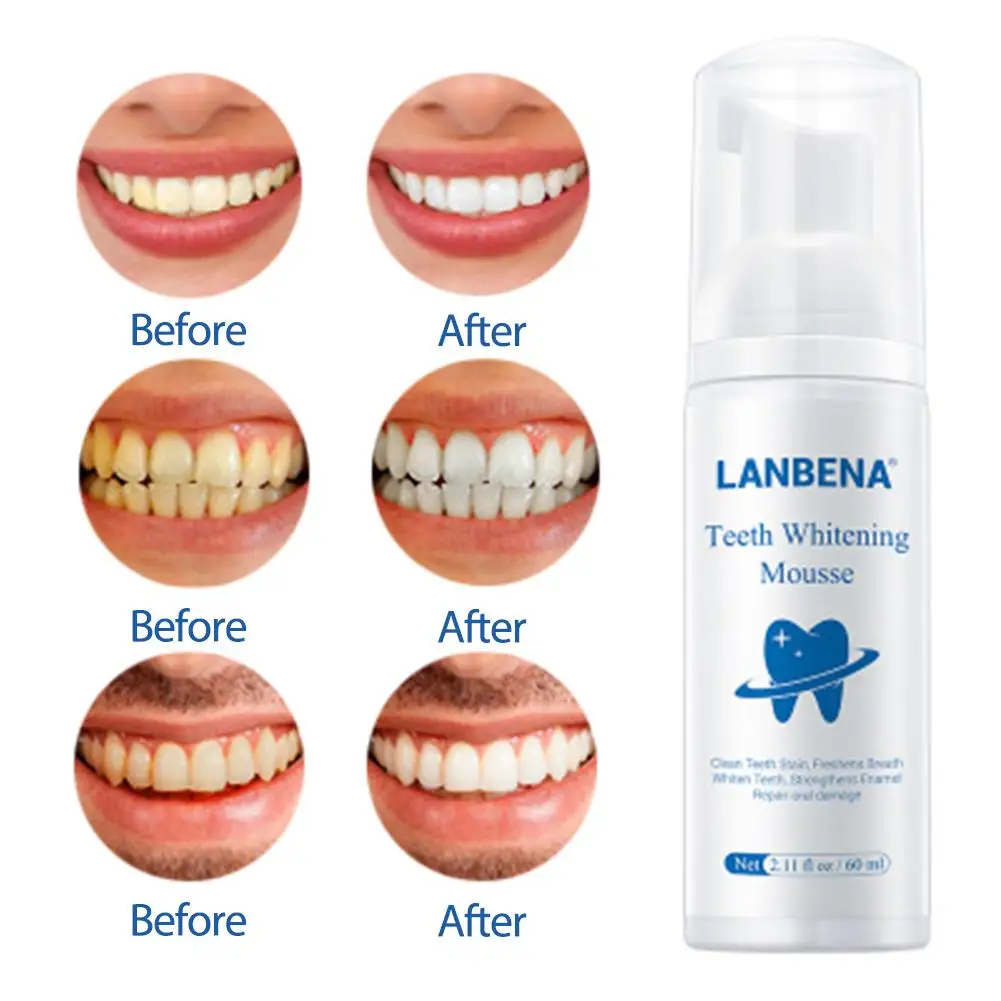 LANBENA Teeth Whitening Mousse Tooth Cleaning White Oral Hygiene Toothpaste Bleaching Remove Stains Dental Tool | Красота и здоровье