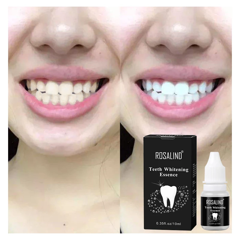 Распродажа! ROSALIND Стоматологический материал отбеливание зубов эссенция гигиена