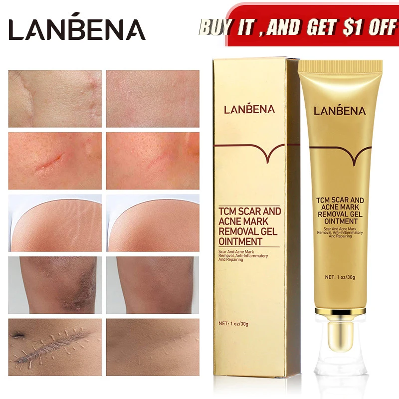

LANBENA Acne Scar Removal Cream Pimples Stretch Marks Face Gel Remove Acne Smoothing Whitening Moisturizing Body Skin Care 30g