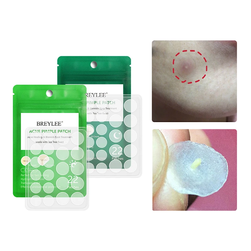 

BREYLEE Acne Pimple Patch Acne Treatment Serum Face Sheet Mask Facial Acne Cream Essence Facial Skin Care Pimple Remover Tools
