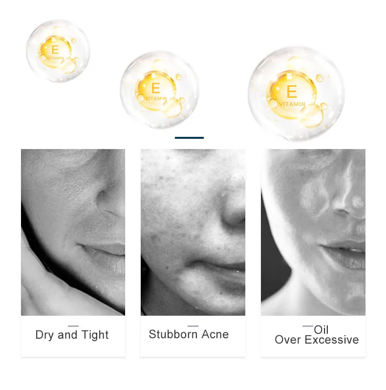 115 г Витамин Е мгновенные результаты гидратация Сыворотка для лица мороженое