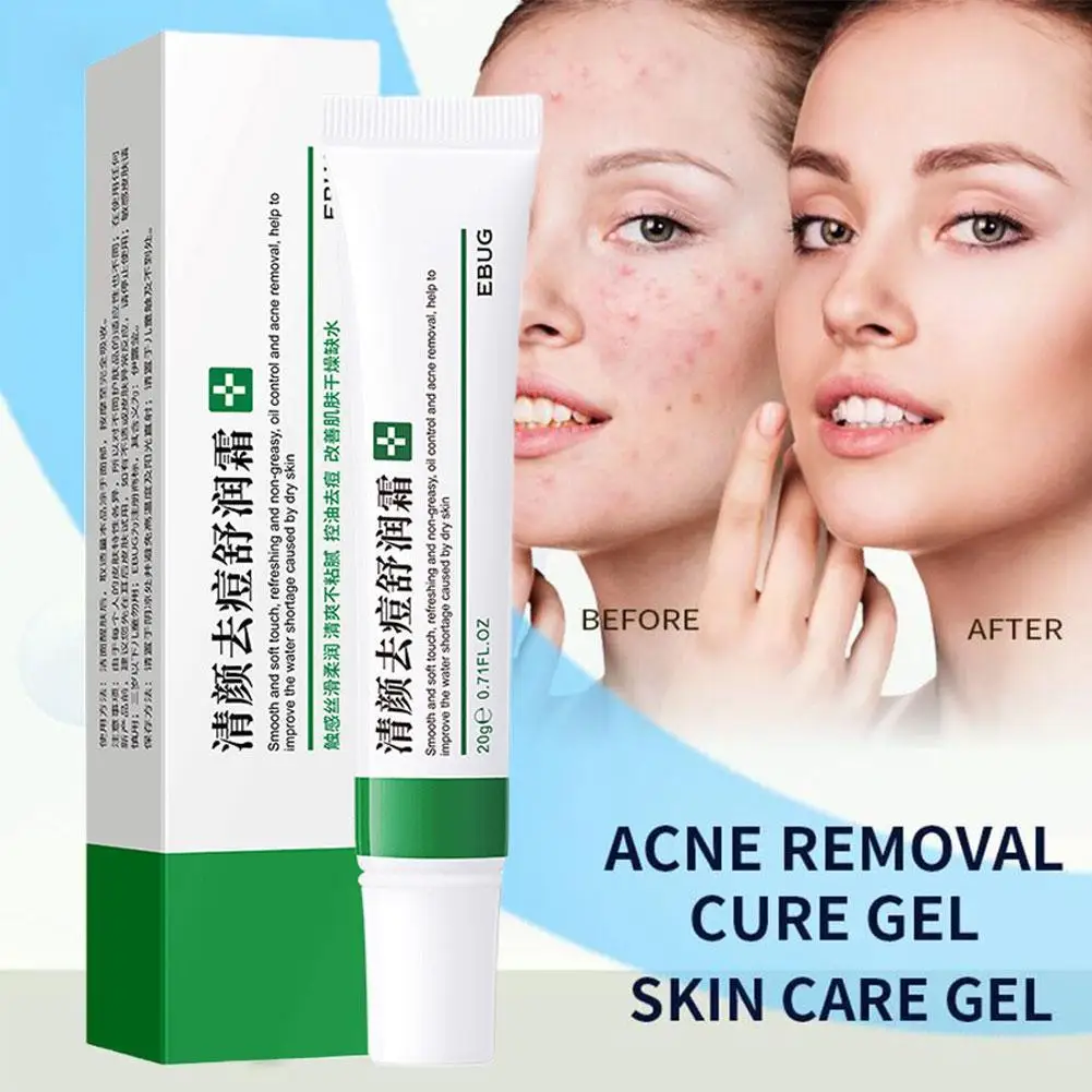 

20g Effective Acne Removal Cream Treatment Fade Acnes Spots Oil Control Shrink Pores Whitening Moisturizing Gel Skin Car