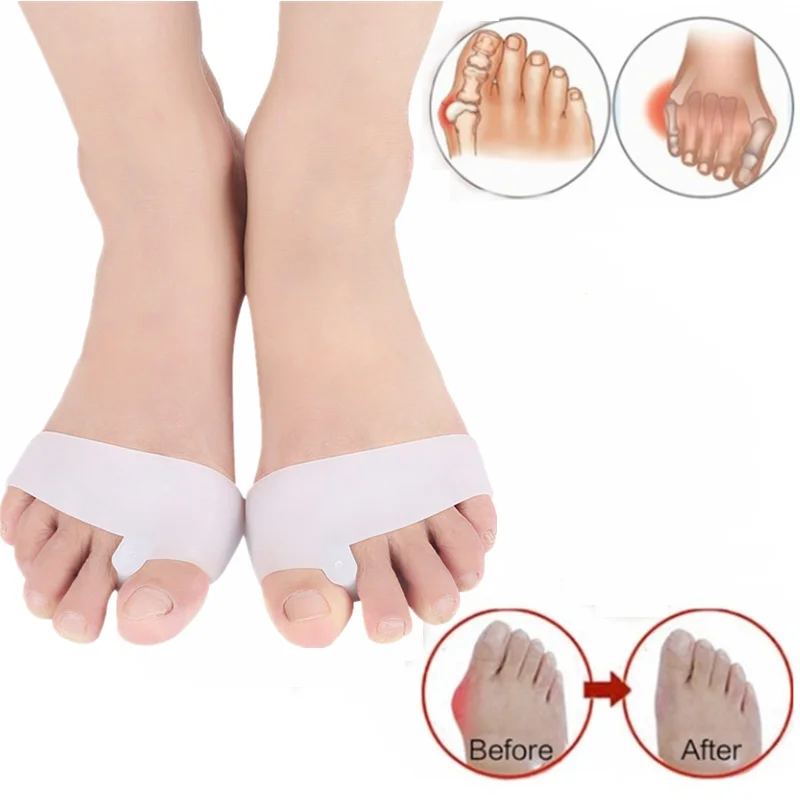 

Инструменты для педикюра, устройство для разделения пальцев ног, при вальгусной деформации