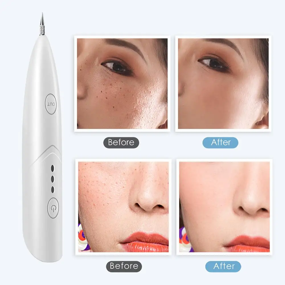 

Beauty Instrument Laser Freckle Remover Comfort Adjustable Machine Mole Non-toxic Skin-friendly Removal Dark Spot Remover