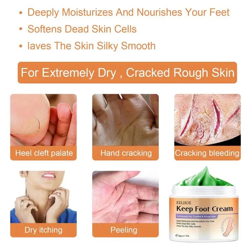 

Anti-cracking anti-aging exfoliating moisturizing foot cream Chinese traditional foot care cream Heel crack repair cream