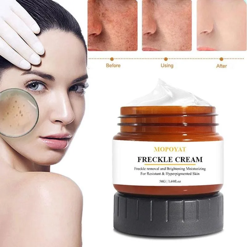 

50ml Freckle Cream Whitening Dark Skin Brighten Skin Tone Fade Dark Spots Melanin Correct Pigmentation Skin Care Face Cream