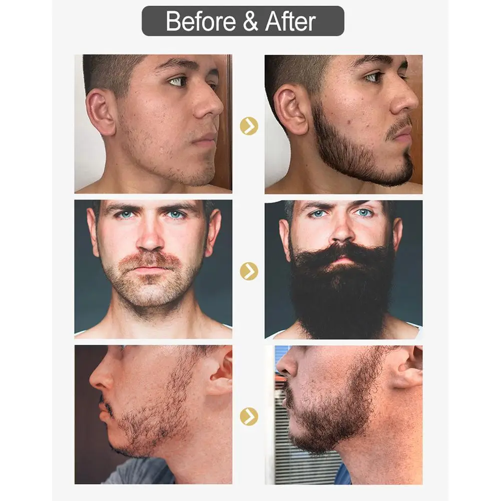 

20ml Beard Growth Serum Preventing Baldness Consolidating Achieve Fuller Anti Hair Loss Nourish Roots Thicker Hair Care