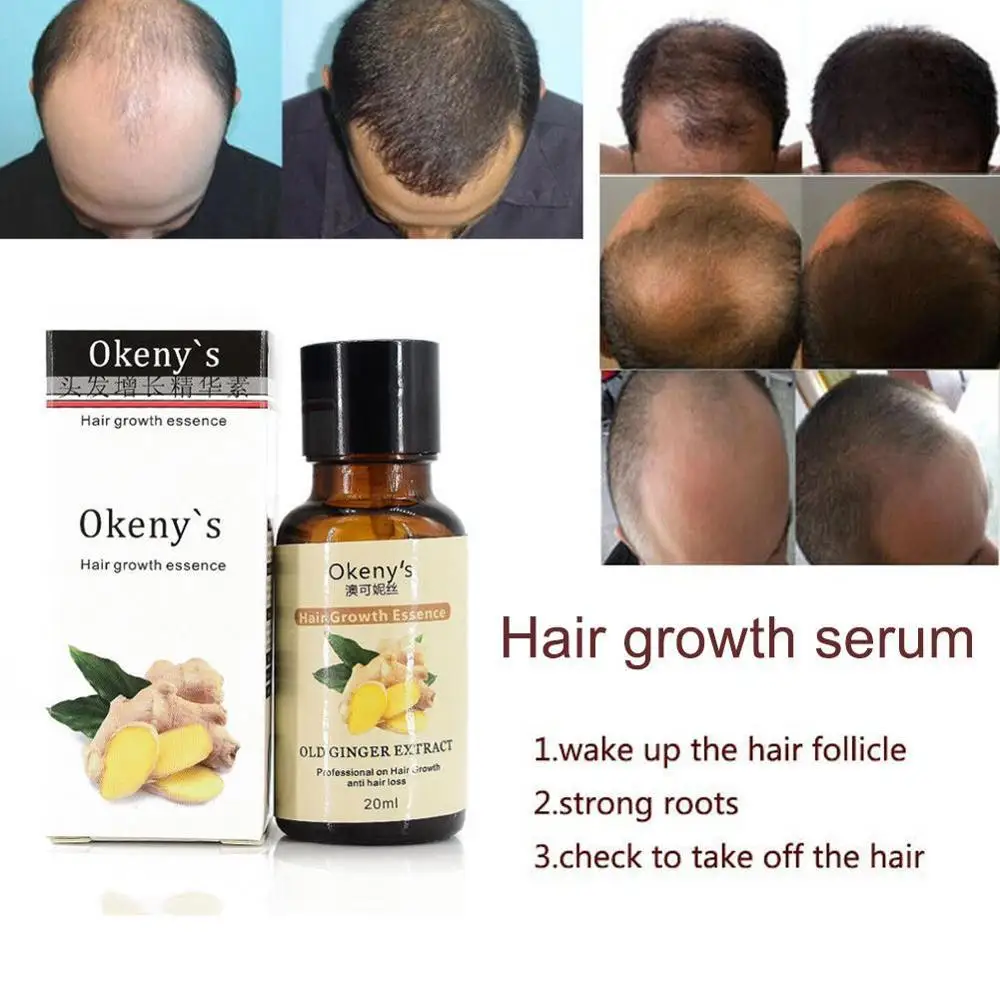 Hair Growth Loss Liquid 20ml Dense 1 Bottle Fast Organic Grow Restoration Pilatory | Красота и здоровье