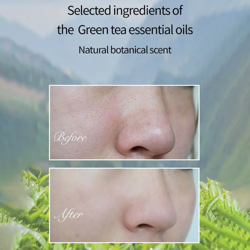 

Black Masks Essence Liquid Blackhead Remover Anti Acne