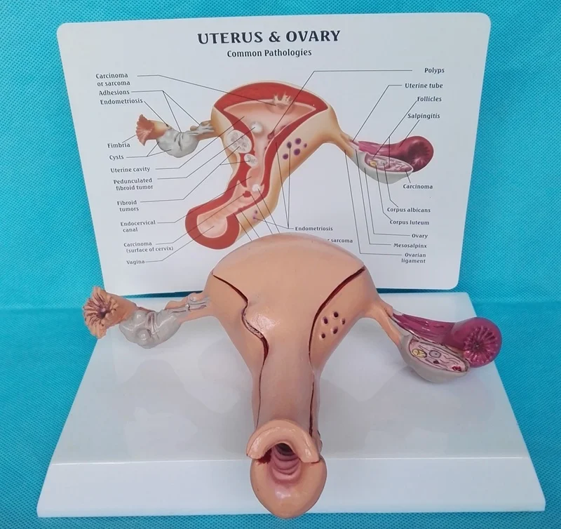 

pathological uterus model Female Advanced simulation pathological uterus model of structure anatomy of gynecology and obstetrics