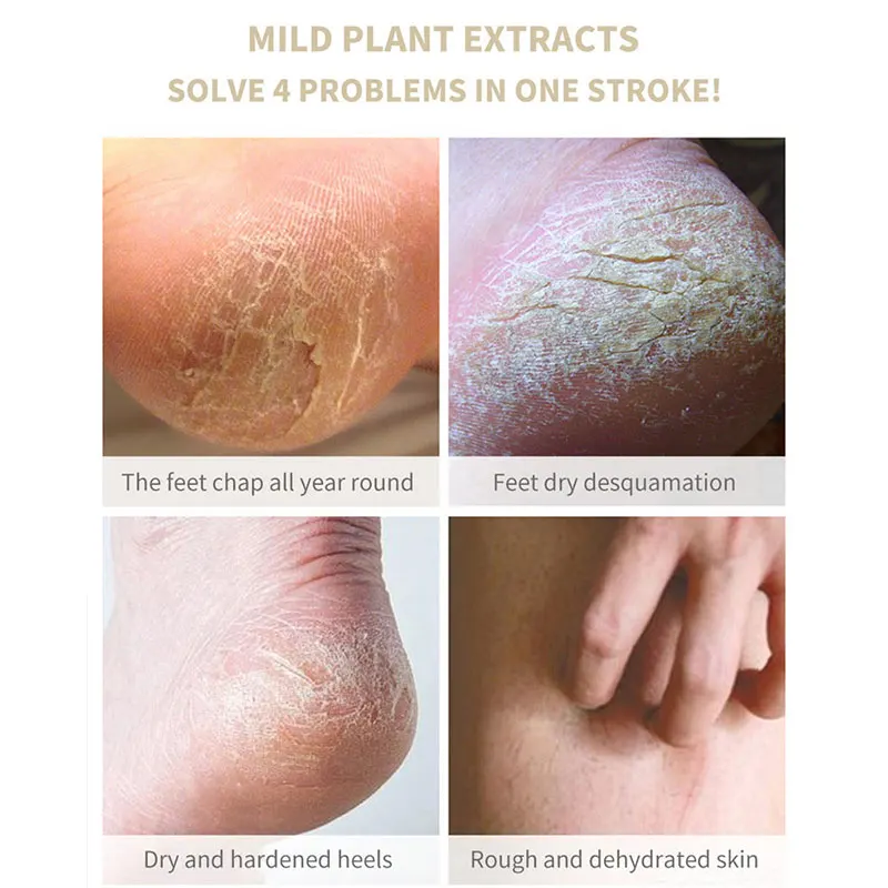 Крем для ног против трещин от на ногах крем удаления омертвевшей кожи