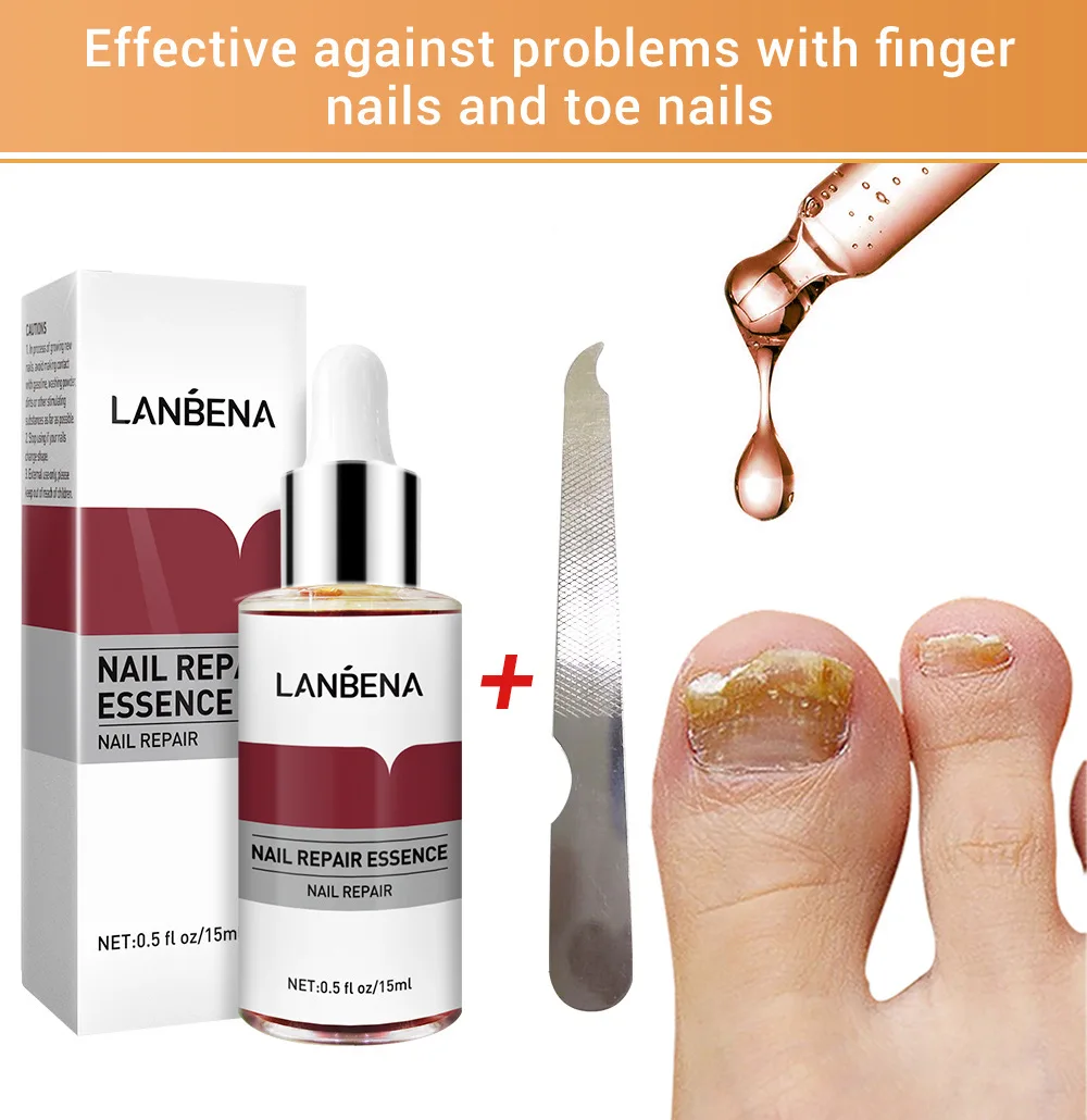

LANBENA Nail Repair Essence Serum Anti Fungal Nail Treatment Remove Onychomycosis Nourishing Brighten Hand Foot Toes Nail Care
