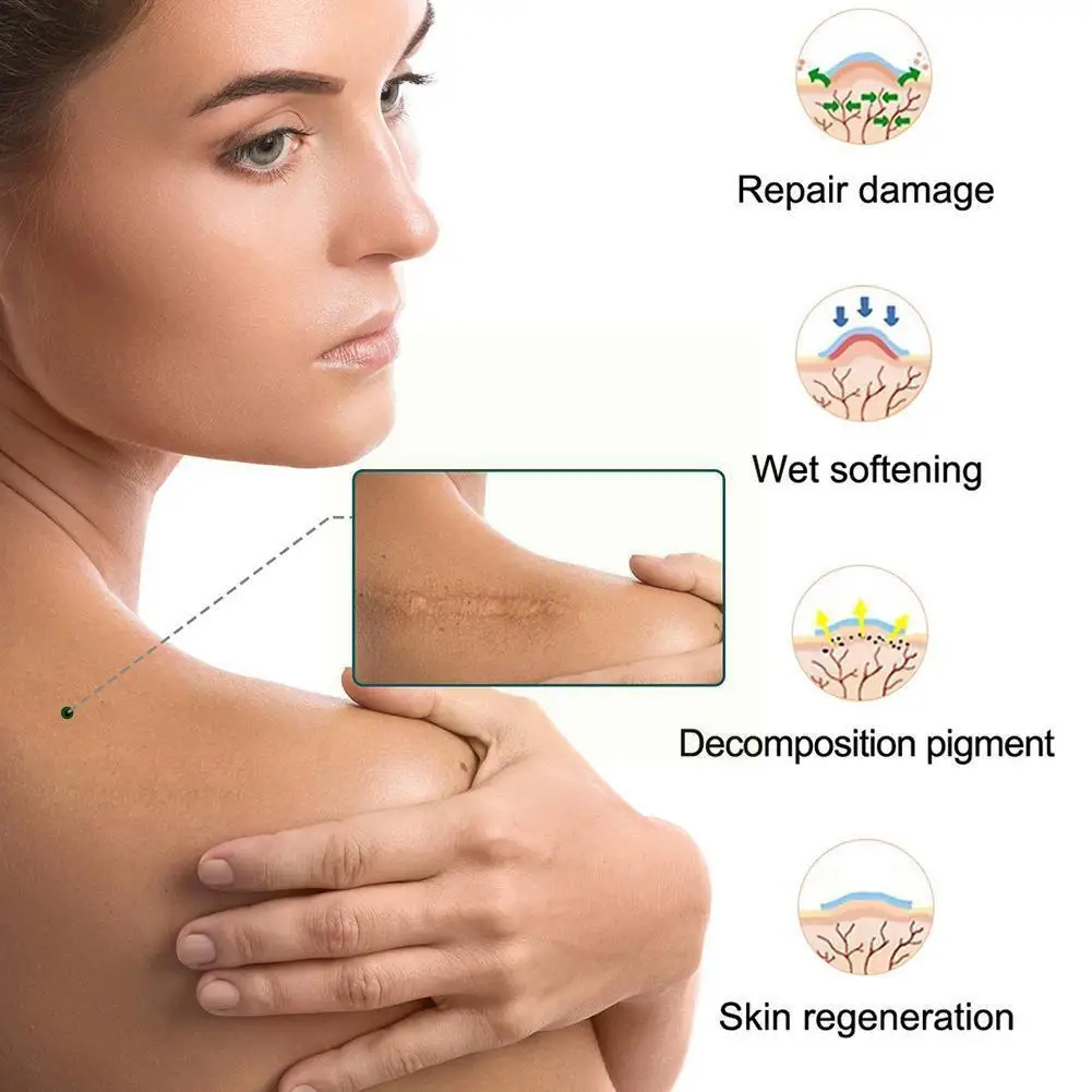 

Fade Scar Stickers Silicone Gel Tape Efficient Beauty Sticker Removal Self-adhesive Scar Skin Care Patch Non-invasive M4c5
