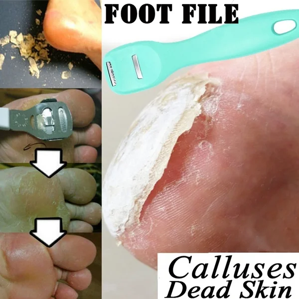 Профессиональный уход за ногами средство для удаления кутикулы удалитель грубой