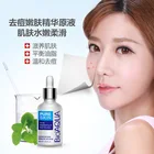 BIOAQUA 30 мл лечение акне эссенция Удаление Шрама от акне жидкие пятна акне уход за кожей лица отбеливающий увлажняющий уход за лицом