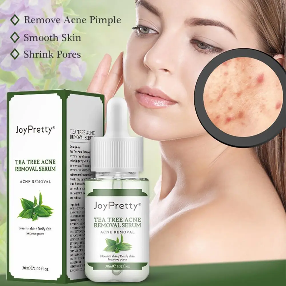 30 мл Чай дерево эфирное масло для удаления угрей шрамы лечение против Шрам Пятна