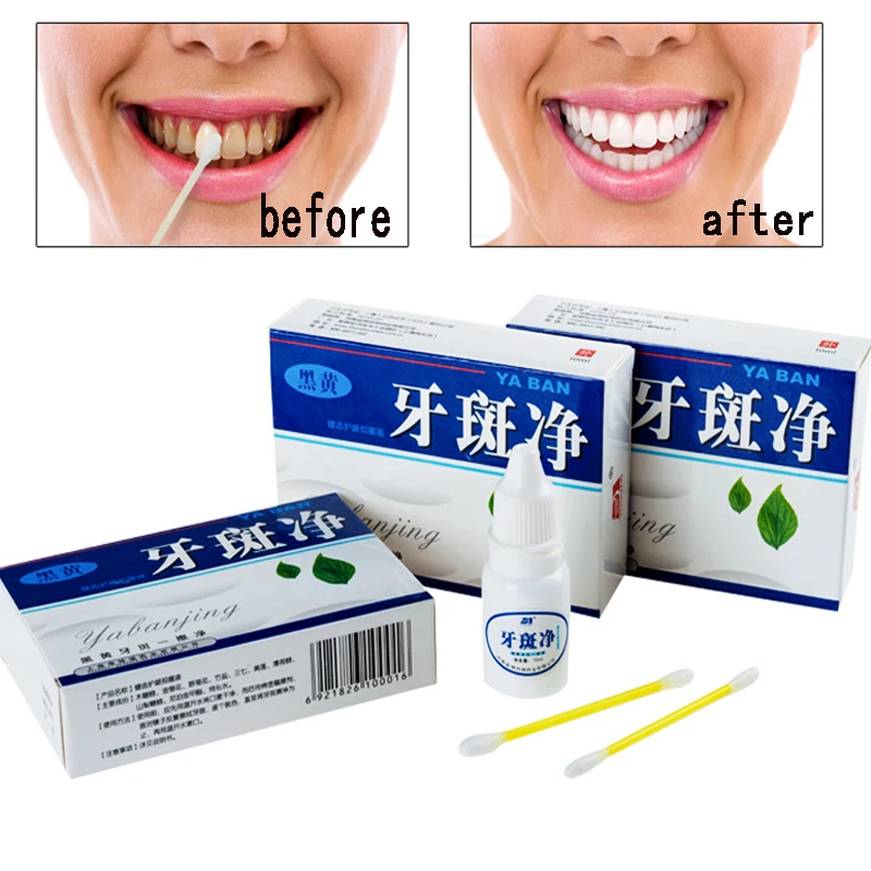 Отбеливающая вода для зубов 10 мл гигиена полости рта уход за зубами чистка