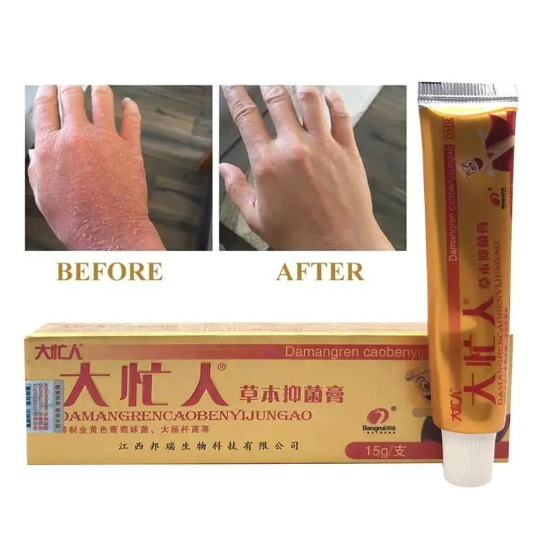 Китайский травяной Антибактериальный крем, псориаз, дерматит Eczema Pruritus Oinments, крем для удаления проблем с зудящей кожей