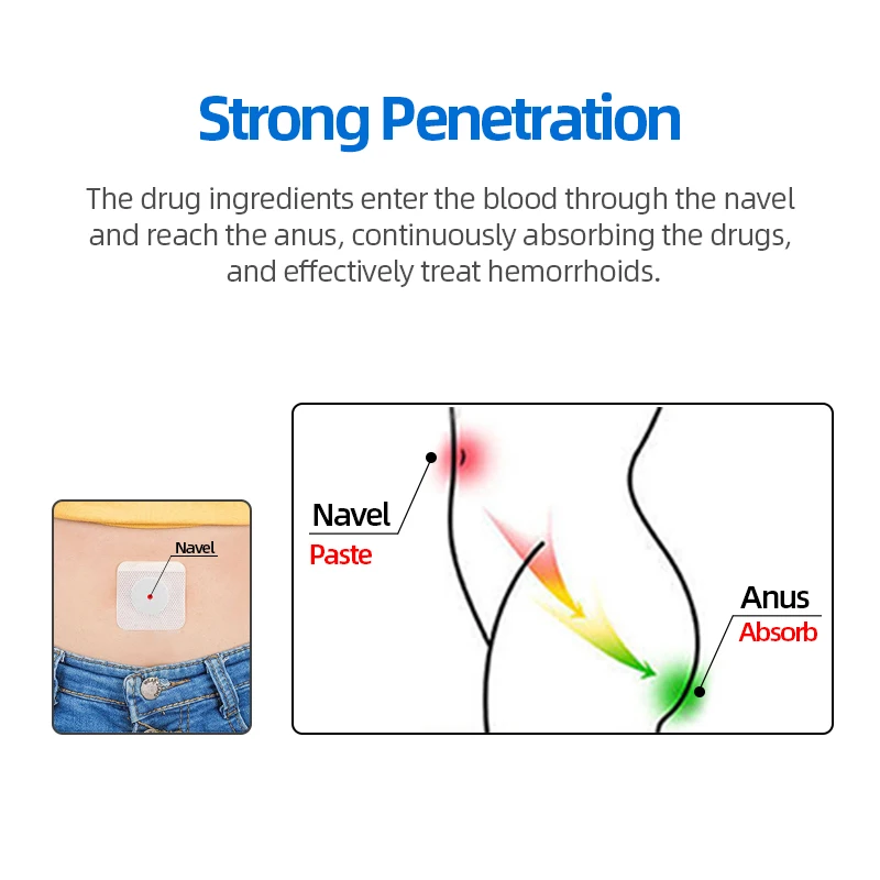 Chinese Hemorrhoids Ointment Patch Sterilize For Internal Piles External Anal Cream | Красота и здоровье