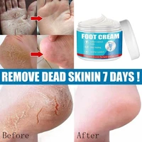 hot foot massage scrub exfoliating cream skin whitening feet cream foot smooth repair care moisturizing cream hand care tool