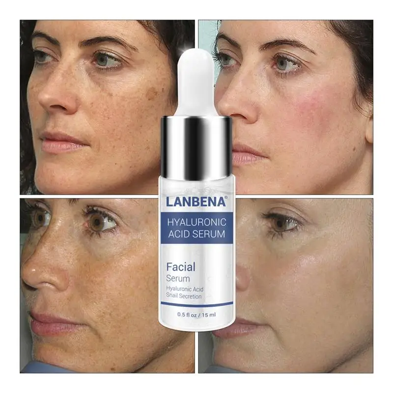 LANBENA Гиалуроновая кислота сыворотка Улитка эссенция лица крем для акне
