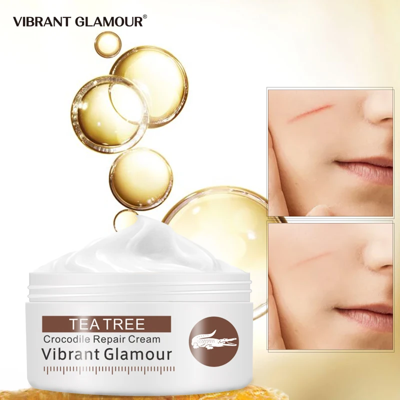 

VIBRANT GLAMOUR Crocodile Face Cream Repair Scar Anti Aging Remove Acne Scar Treatment Stretch Marks Lightening Skin Care 30g