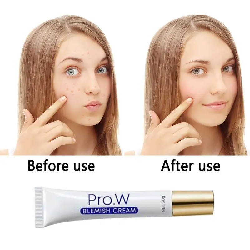 

30g Pro.W Blemish Cream Freckles Acne Pimple Scar Dark Spots Removal Skin Whitening Brightening Moisturizing Face Care DROPSHIP