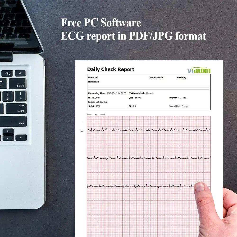 Портативный монитор ЭКГ Checkme Pro для апноэ во время сна Домашнее использование