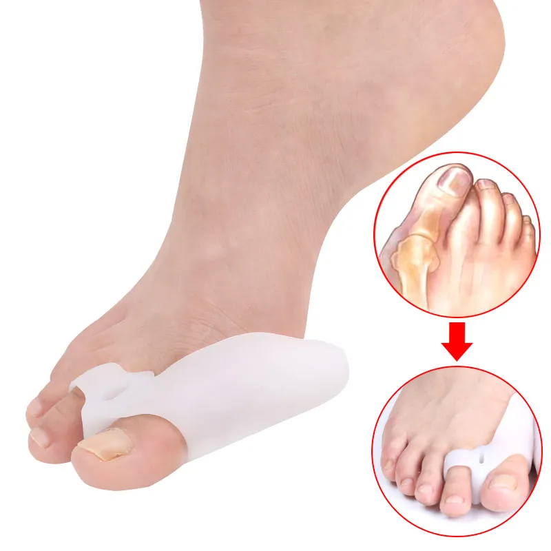 9 Pcs/set Orthopedic Bunion Correction Pedicure Socks Silicone Hallux Valgus Corrector Braces Toes Splitter Set | Красота и здоровье