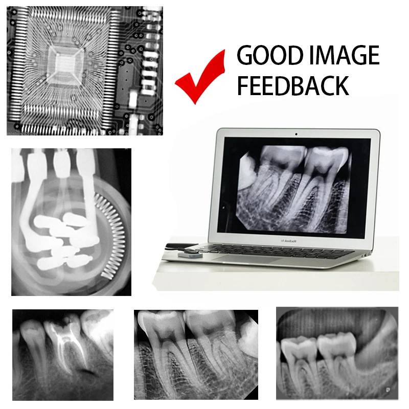LCD Touth-Screen High Frequency Digital Wireless Camera Portable Dental X-ray Machine | Красота и здоровье