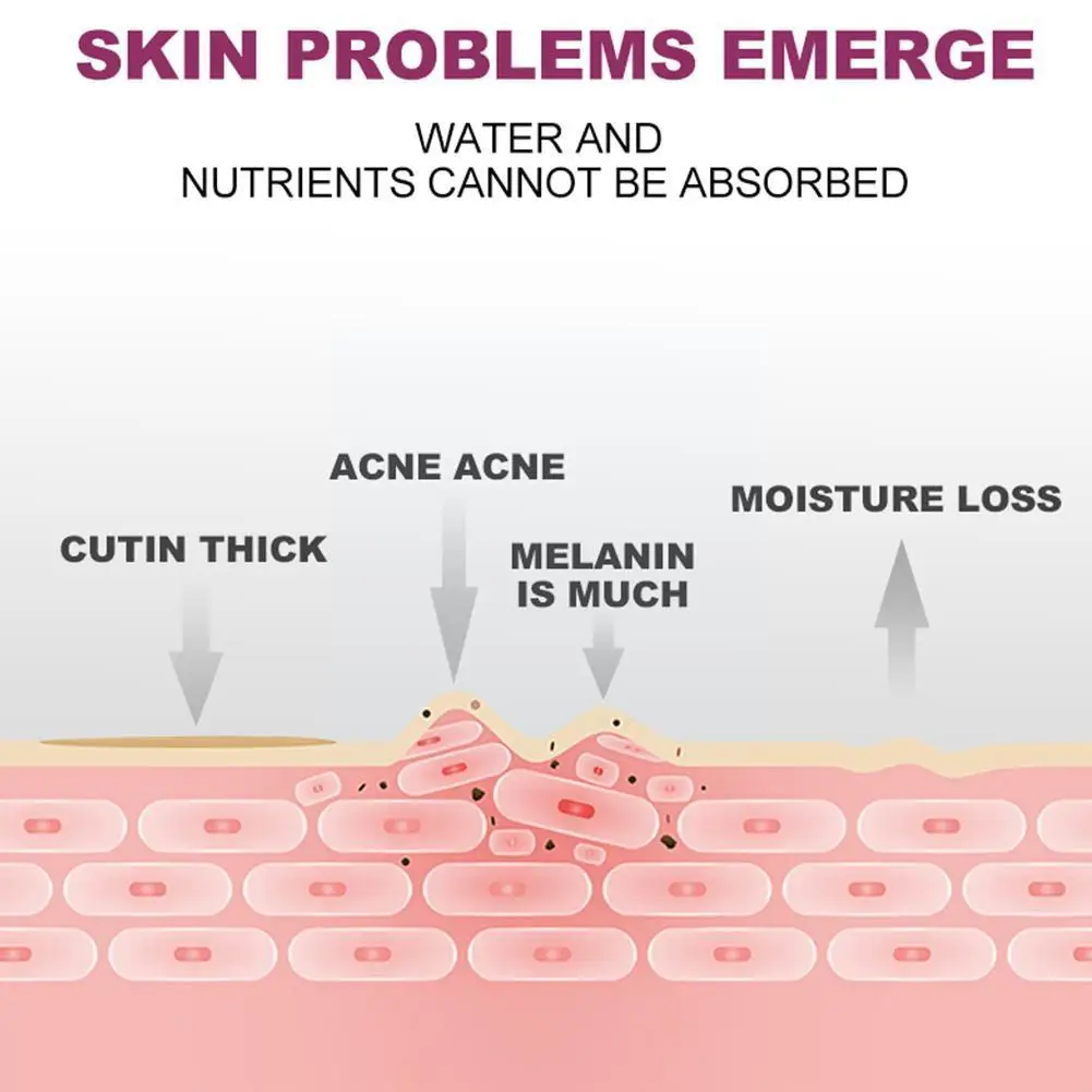 

Deep Cleaning Face Exfoliating Cream Whitening Moisturizer Repair Skin Remove Cleaner Treatment Acne Care Blackhead Scrub H9X9