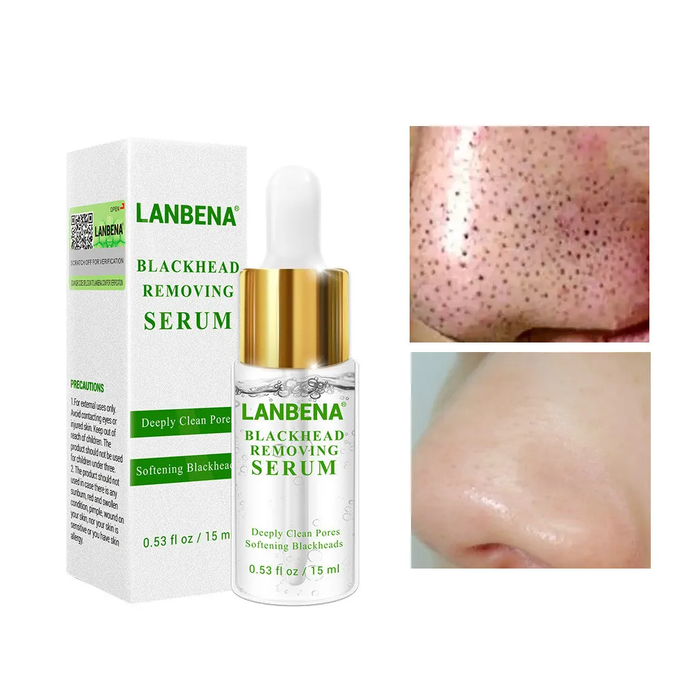 LANBENA Удаление угрей сывороточная эссенция глубокие поры акне прыщи бережное